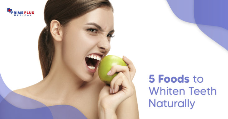 Foods to whiten teeth naturally - foods to avoid when whitening teeth - how to whiten teeth naturally fast - Tips by Prime Plus Medical Bali