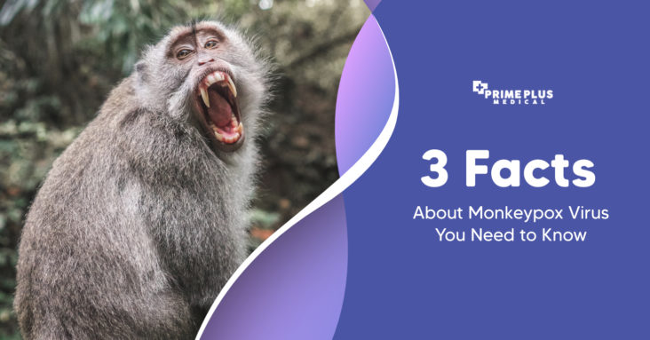 3 Facts About Monkeypox Virus You Need to Know