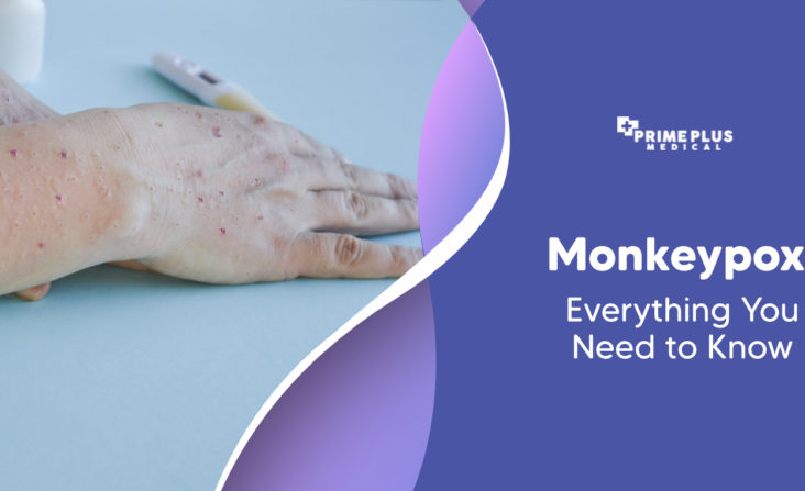 Monkeypox - Everything You Need to Know