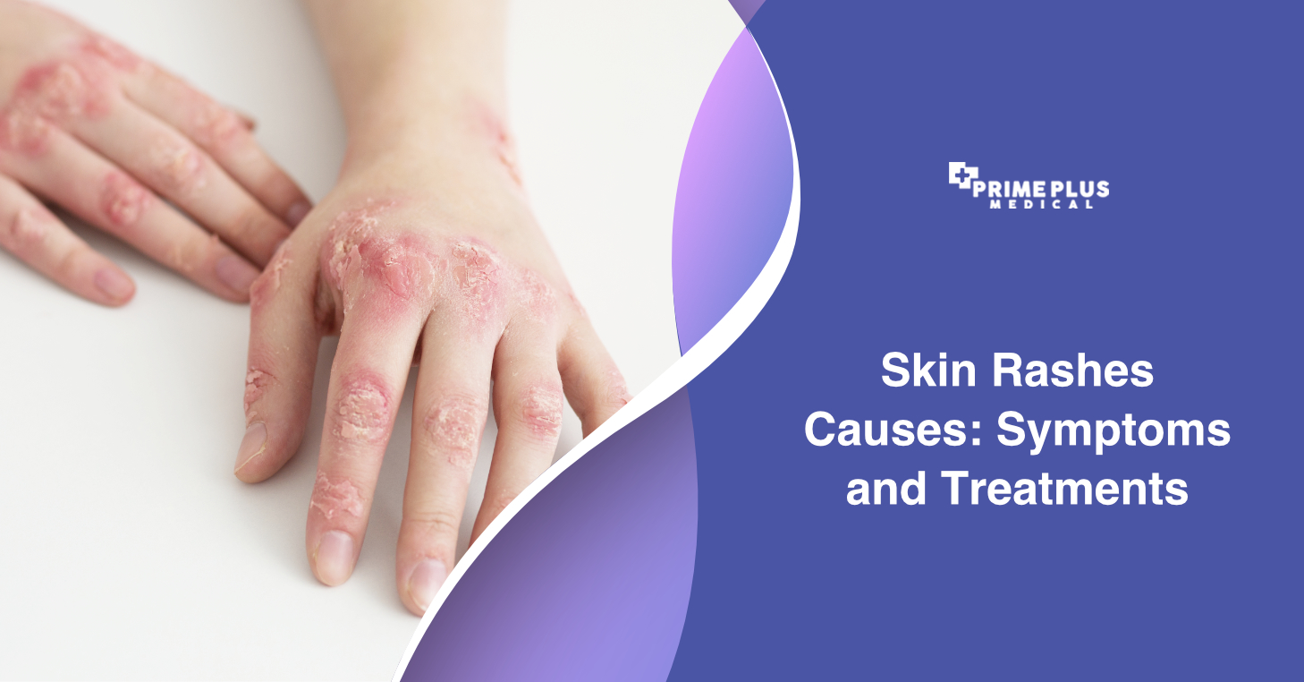 Periungual peeling of skin in both feet. | Download Scientific Diagram