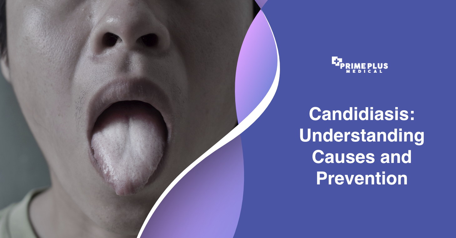 Candidiasis: Understanding Causes and Prevention - Prime Plus Medical