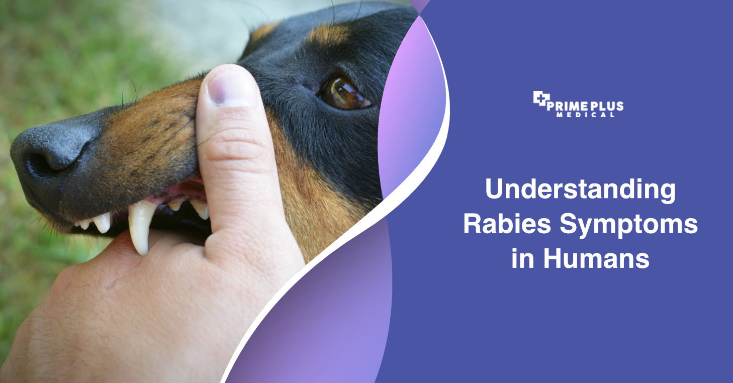 Symptoms of rabies in dogs sales to humans