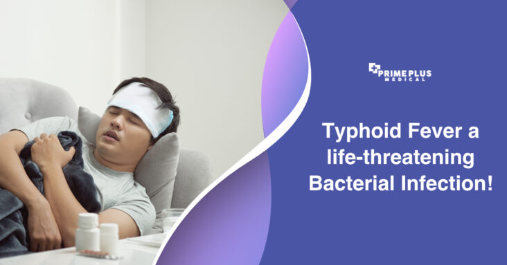 Typhoid fever is a serious and potentially life-threatening bacterial infection that affects millions of people worldwide each year.