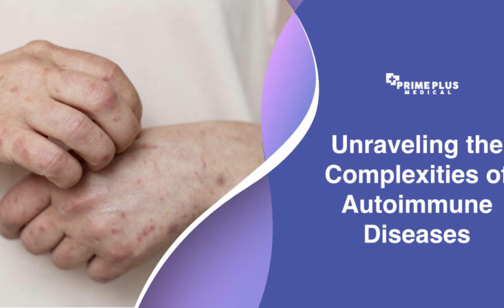 Explore the complexities of autoimmune diseases, their symptoms, and innovative treatments in this insightful article.